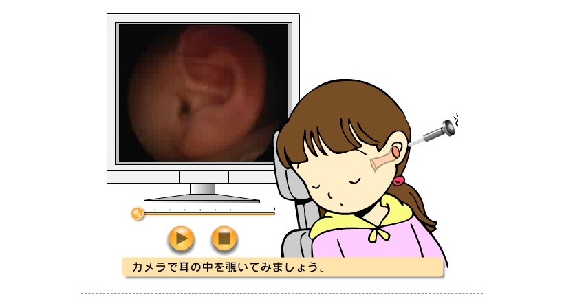 動画で見る耳の状